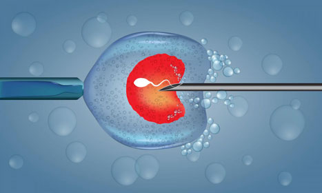 Centre-de-Fertilité-PMA_Traitement-et-PMA_ICSI---467x280